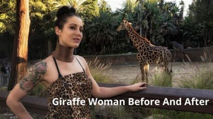 The giraffe woman who spent 5 years stretching her neck with rings to look like her favorite animal
